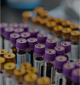 Lightnovo Advances Rapid Bacteria Identification Through MbCARE Initiative